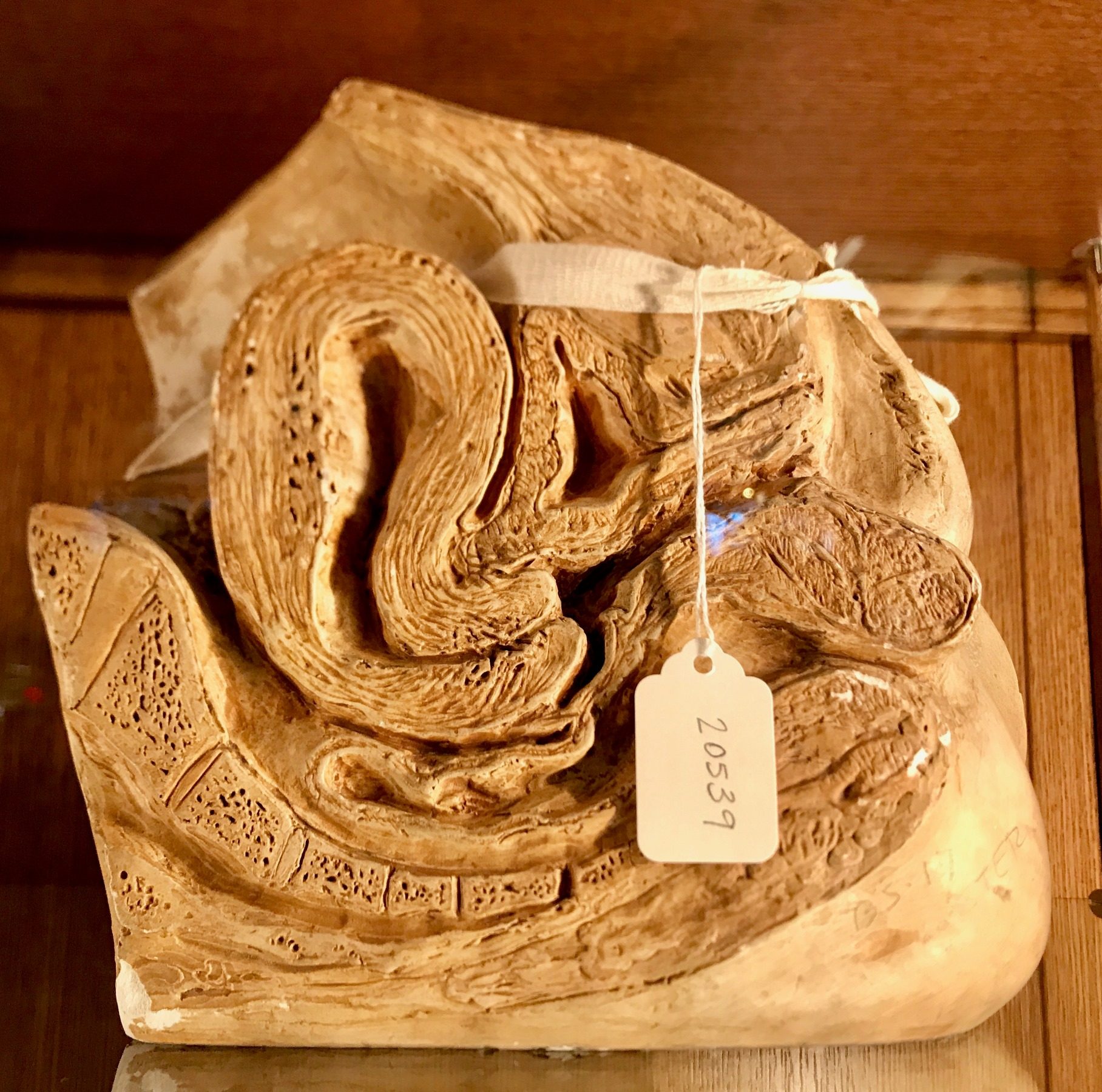Dickinson-Belskie Collection, Warren Anatomical Museum, Boston (by Luca Ambrosio) (1).jpg
